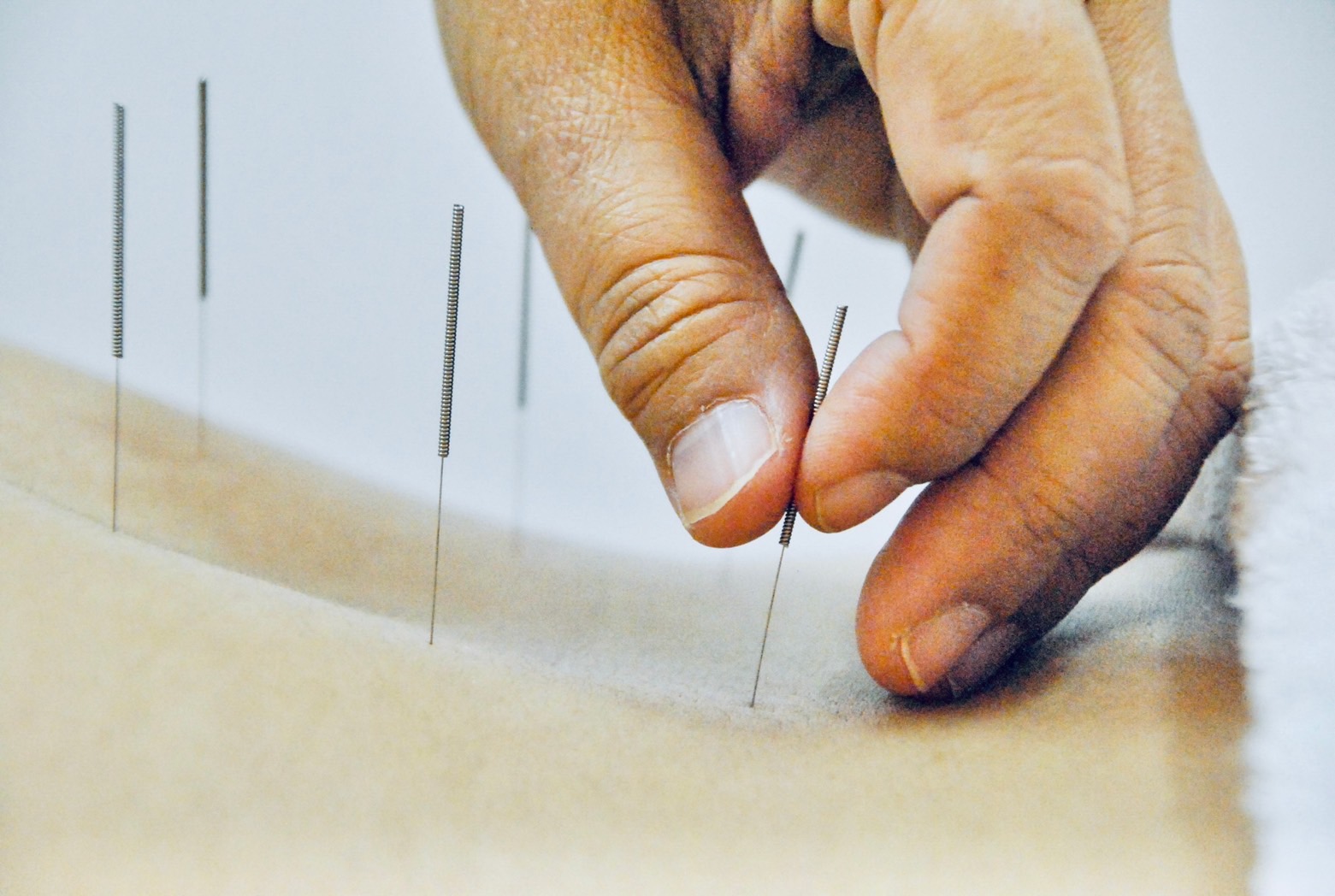 Pattaya Acupuncture Clinic, Rompho, Pattaya, acupuncture