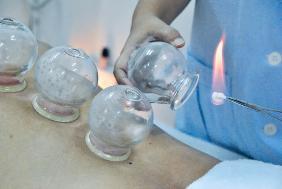 Pattaya Acupuncture Clinic, Rompho, Pattaya, cupping
